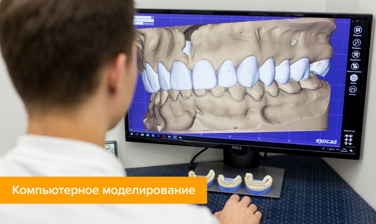 Фото стоматолога проводящего компьютерное моделирование