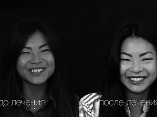 Лечение на брекетах в SmileClinic - до/после
